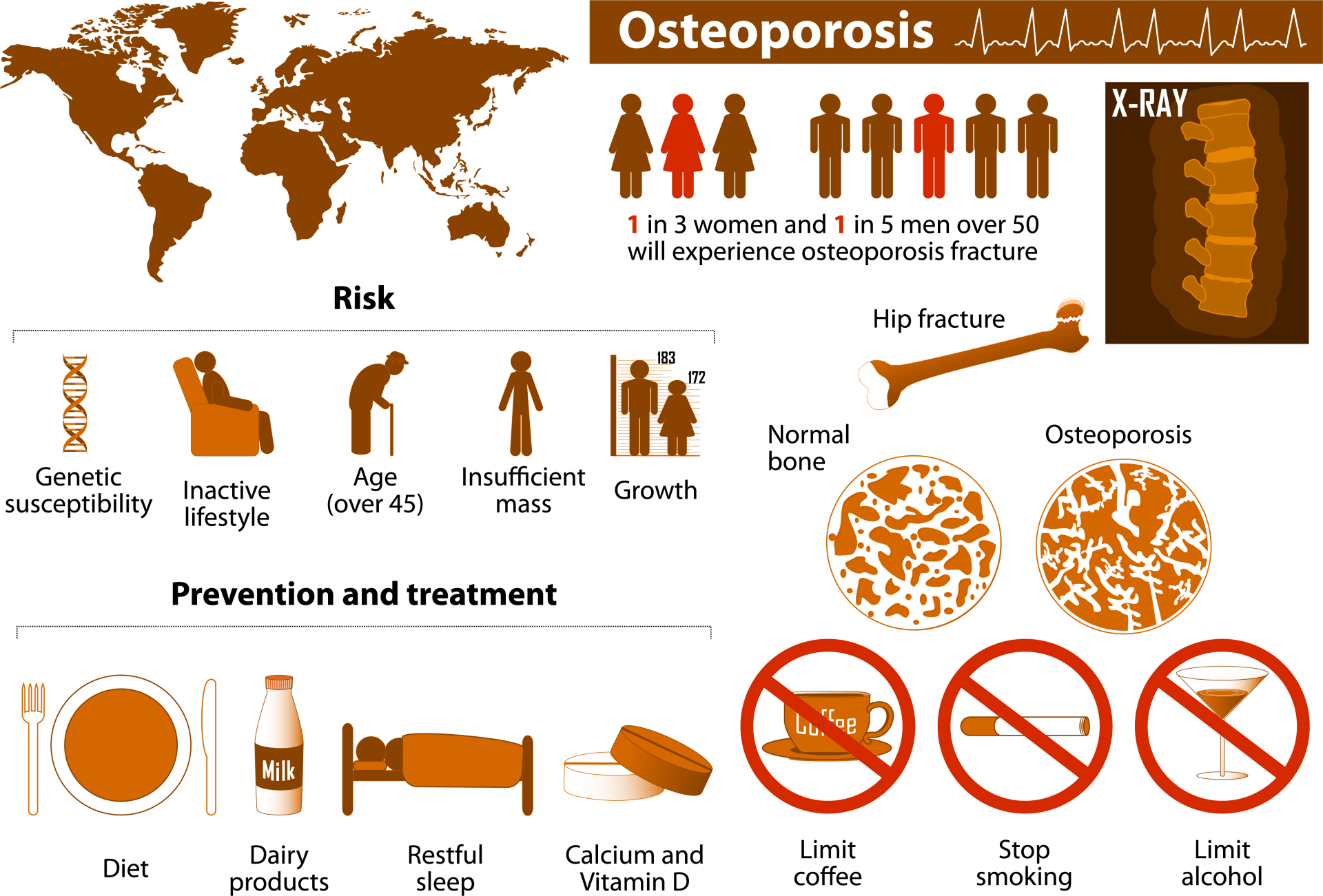 prevent osteoporosis prevent osteoporosis